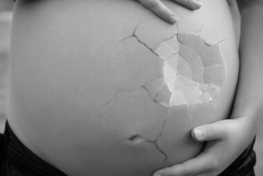 Qué pasa en el quirófano con el aborto